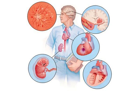 Deteriorarea diferitelor organe cu hipertensiune arterială prelungită